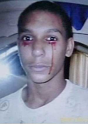 世界上真实存在的异变人