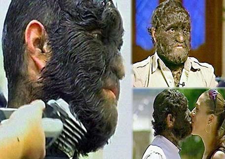 世界上真实存在的异变人